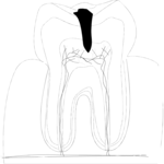 Tooth 04