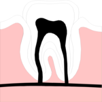 Tooth & Root